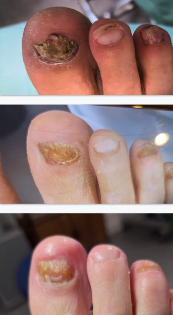 Bron : Praktijk Visser Reeuwijk